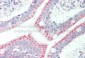 SLC33A1 antibody - middle region
